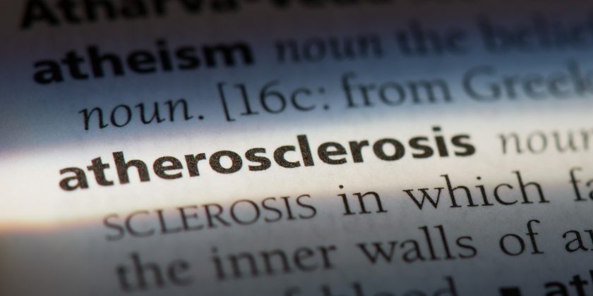 Атеросклерозата: Тихият крадец на сърдечно-съдовото здраве